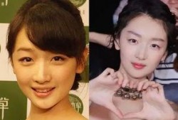 林志玲美白针爆料视频播放,揭秘明星美容秘籍
